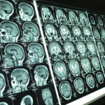 Power Doesn’t Just Corrupt, It Can Rewire Your Brain TLNT