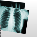 Scrape X-Ray for Research Including Diversity Irini Shamaeva